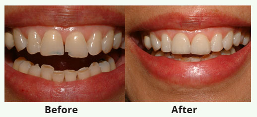 cosmetic Dentistry service
